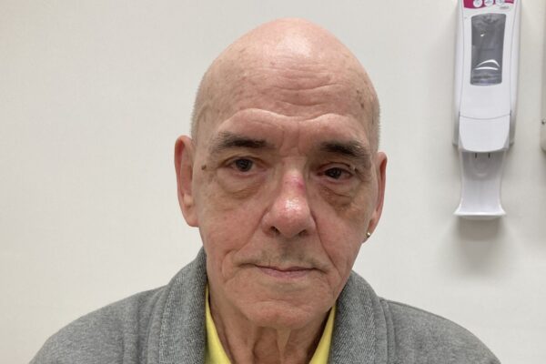 Quitting smoking: Alfie Thompson’s inspiring journey to a healthier life shows it’s never too late to quit smoking.